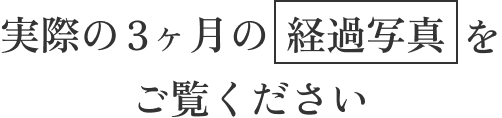 実際の3ヶ月の経過写真をご覧ください